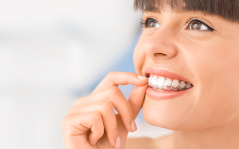 Common Invisalign Questions Answered By Dentist In Boca Raton
