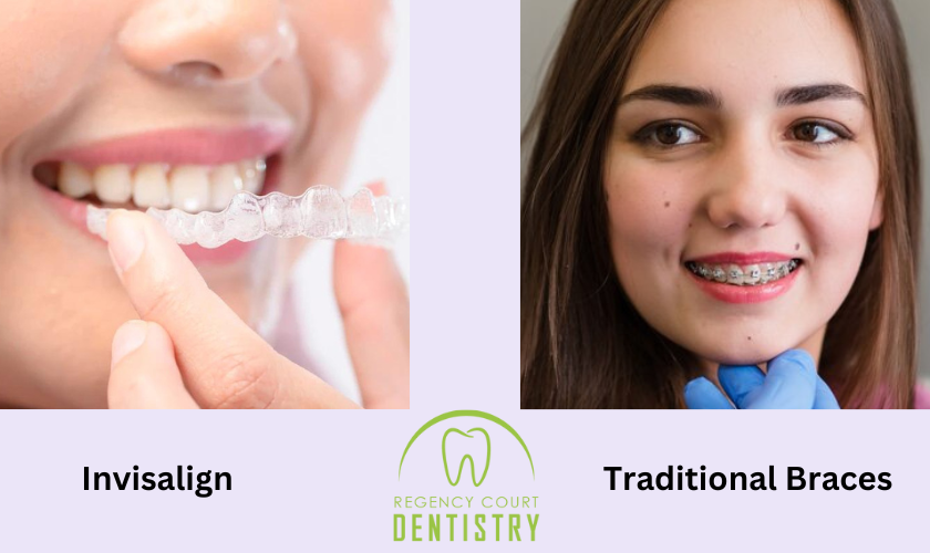 Know The Difference Between Invisalign &#   ; Traditional Braces