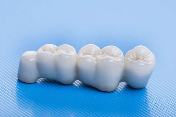 How Many Teeth Can Dental Bridges Replace from Regency Court Dentistry in Boca Raton, FL