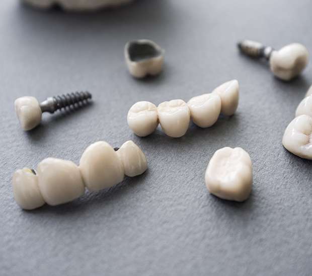 Boca Raton The Difference Between Dental Implants and Mini Dental Implants