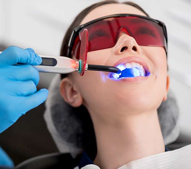 Boca Raton Professional Teeth Whitening