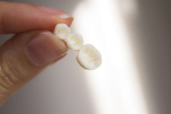 Replace Missing Teeth with Dental Bridges from Regency Court Dentistry in Boca Raton, FL