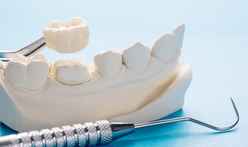 Final Decision On Same Day Crown And Traditional Crown