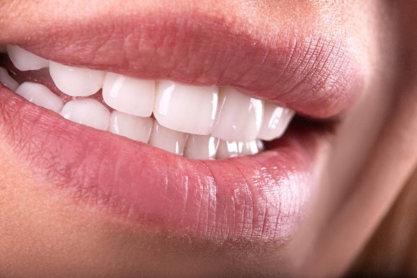 When Should I Schedule A Smile Makeover Consultation?